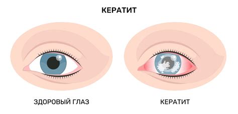 Альтернативные варианты: новые решения для проблемы болезней глаз