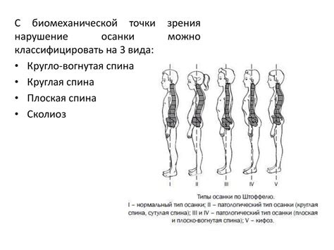 Анализ осанки рыцарей