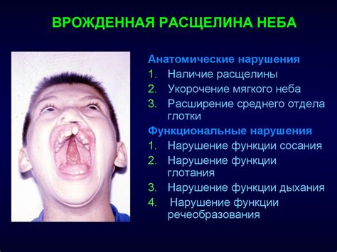 Анатомические причины улыбки умершего