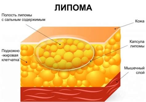 Влияние жировой ткани и мышц на плавучесть