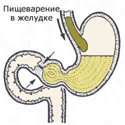 Воздушные пузырьки в желудке