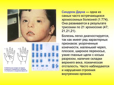 Врожденные заболевания