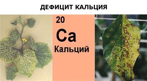 Дефицит магния и кальция