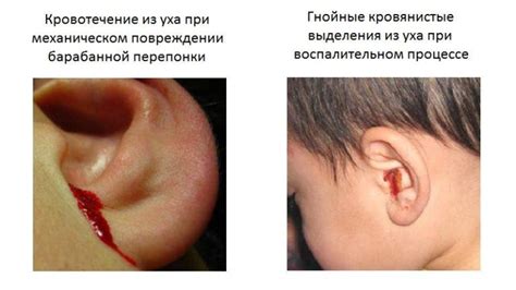 Заболевания, приводящие к нестоянию ушей