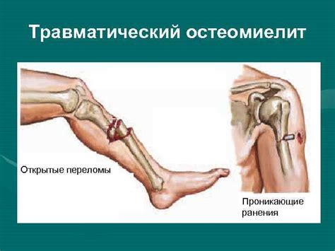 Заболевания костей и суставов