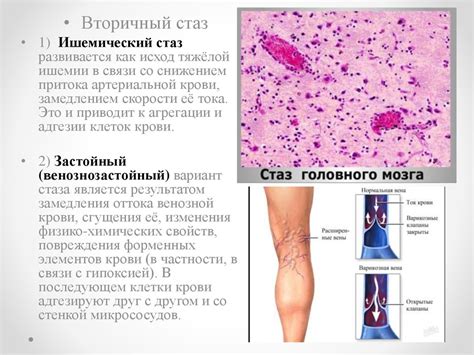 Значение и причины
