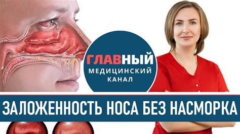 Какие факторы влияют на хрюканье носа без соплей