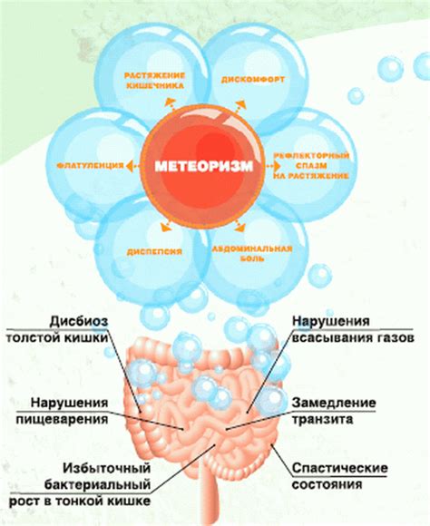 Метеоризм и накопление газов в кишечнике