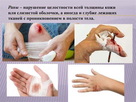 Механические повреждения тахометра