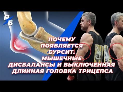 Мускульные дисбалансы