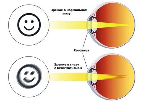 Нарушение зрения