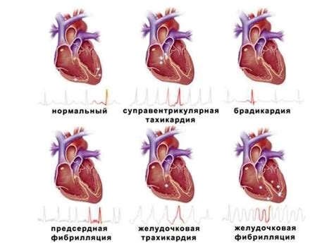 Нарушение работы сердца