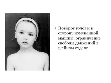 Ограничение свободы движений