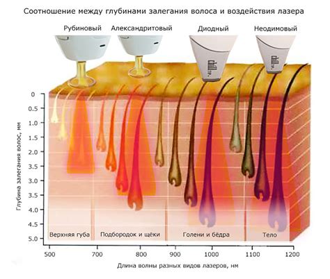 Опасности лазерной депиляции