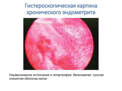 Острые и хронические заболевания, приводящие к этому состоянию