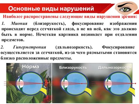 Отсутствие навыков фокусирования глаз