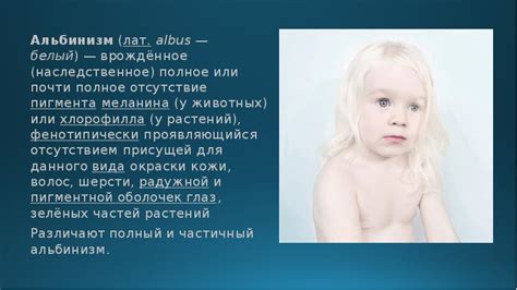 Отсутствие специального пигмента