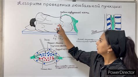 Ошибки при проколе