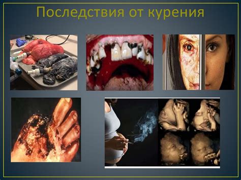 Пагубное влияние семечек на духовное здоровье