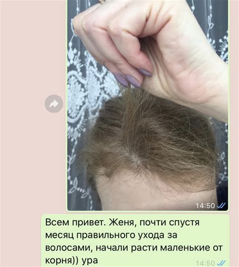 Плотный рост волос