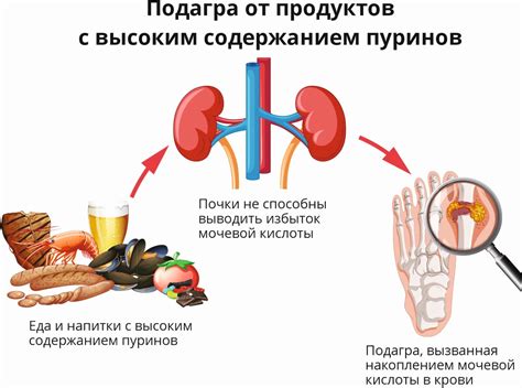 Подагра и другие медицинские причины