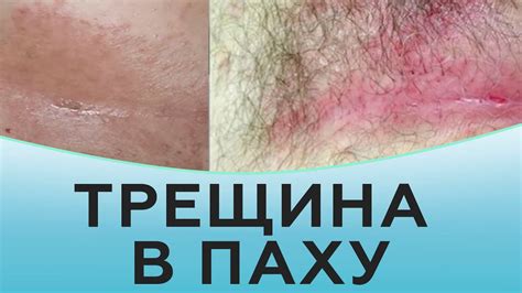Популярные тренды бритья паховой зоны в России