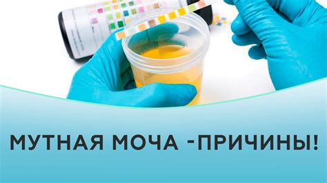 Почему моча может стать мутной в холодильнике у ребенка