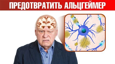 Предрасположенность по эволюционным причинам