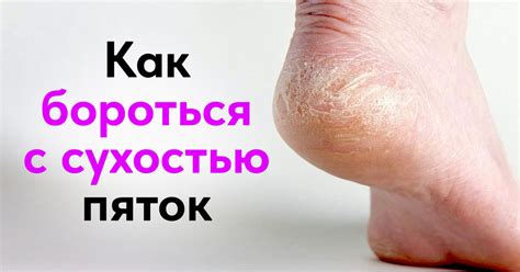 Причины печения левой пятки и их значение