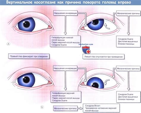 Причины поворота