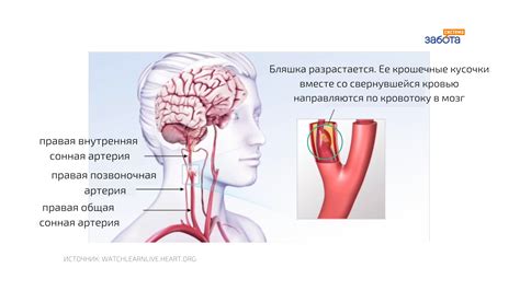 Причины разрыва звонка