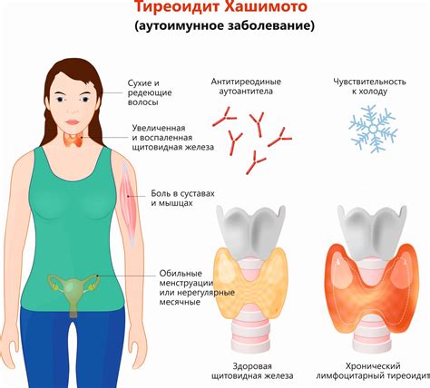 Проблемы совместимости и железа