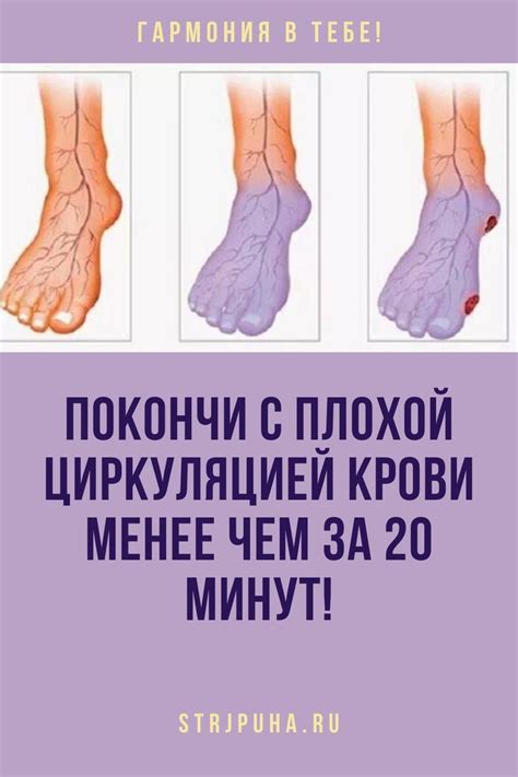 Проблемы с циркуляцией крови