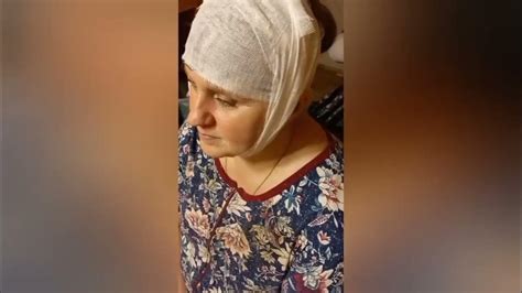 Противопоказания полуспиртового компресса