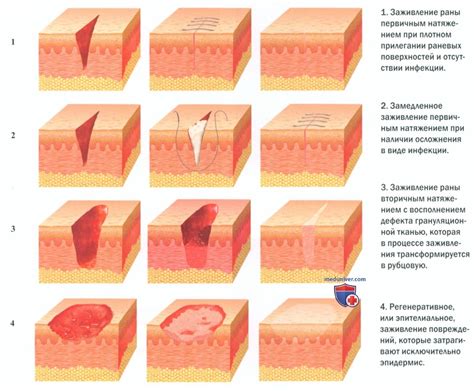 Процесс заживления