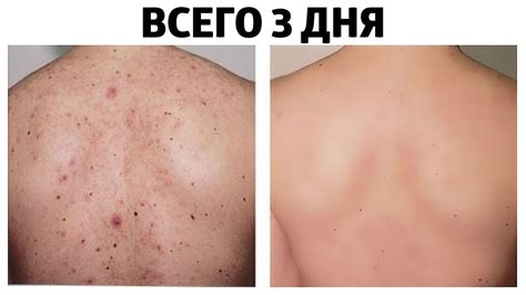 Реакция с кожей