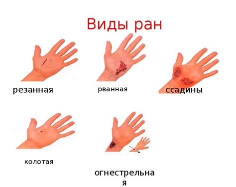 Риск повреждения кожи и околоногтевых тканей