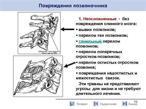 Риск повреждения позвоночника