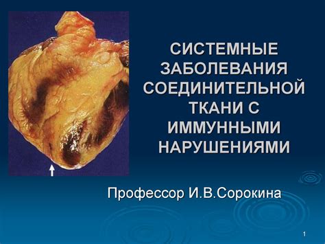Системные заболевания, которые влияют на кровоснабжение