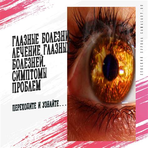 Скрытие глазных проблем