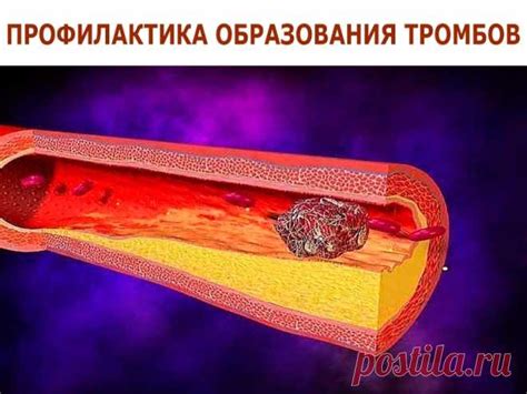 Снижение возможности образования тромбов