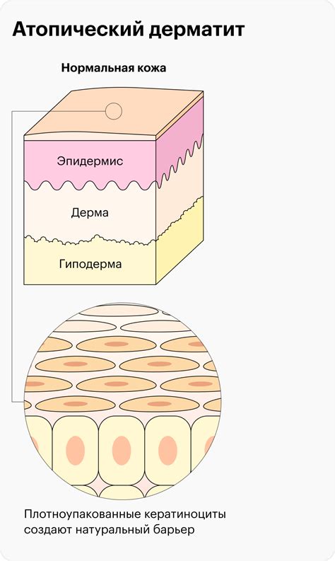 Снижение частоты мытья