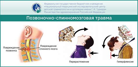 Травма позвоночника