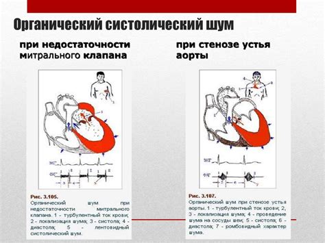 Ускользание споткнувшегося человека