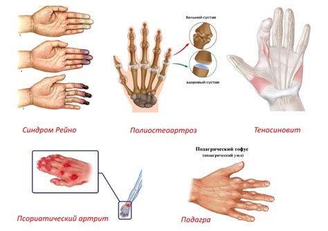 Физиологические причины толстых пальцев