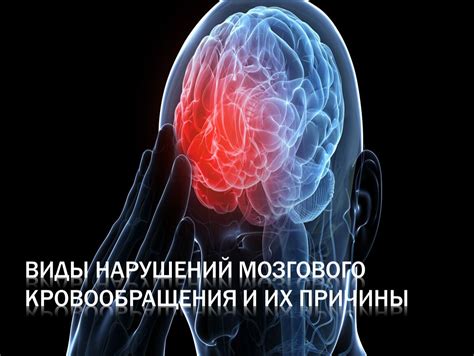 Частые причины мозгового напряжения