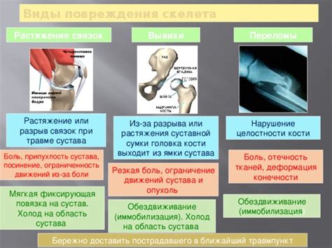  Ограничение движений 