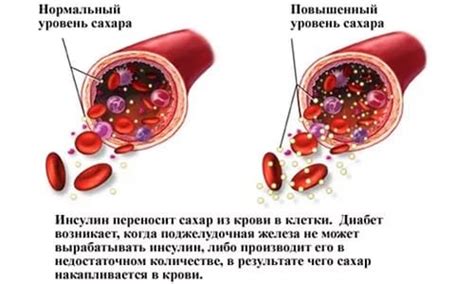  Ролевая игра в повышении уровня инсулина и роста гормона 